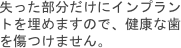 失った部分だけにインプラントを埋めますので、健康な歯を傷つけません。