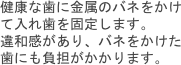 健康な歯に金属のバネをかけて入れ歯を固定します。
違和感があり、バネをかけた歯にも負担がかかります。