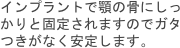 インプラントで顎の骨にしっかりと固定されますのでガタつきがなく安定します。